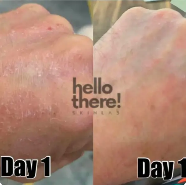 Hello There Skinlab Testimony